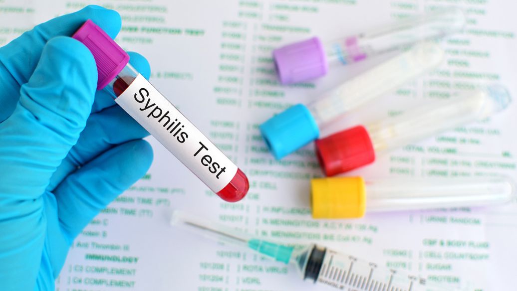 去哪里做亲子鉴定比较正规